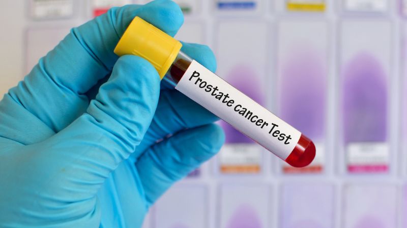 best way to test for prostate cancer